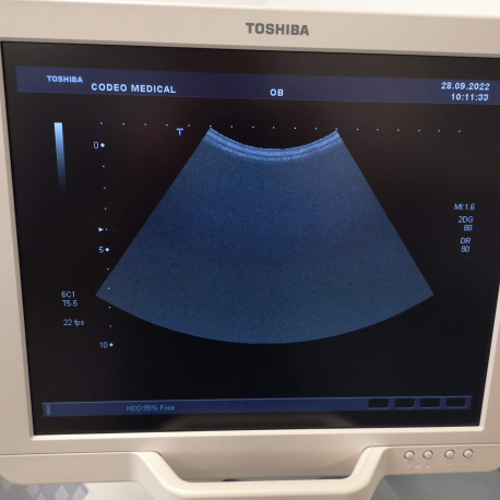 Ultrasound Toshiba APLIO SSA-700A